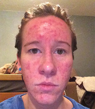 kim mcclintock before