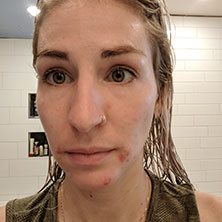 Madison before image