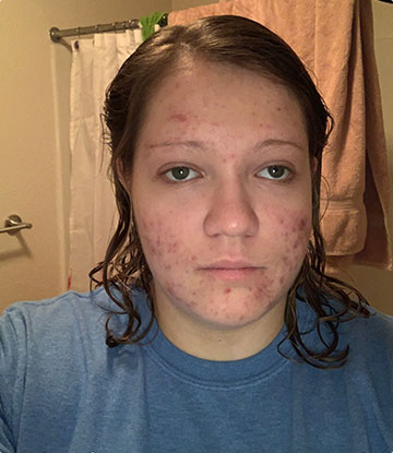 michaela weaver before